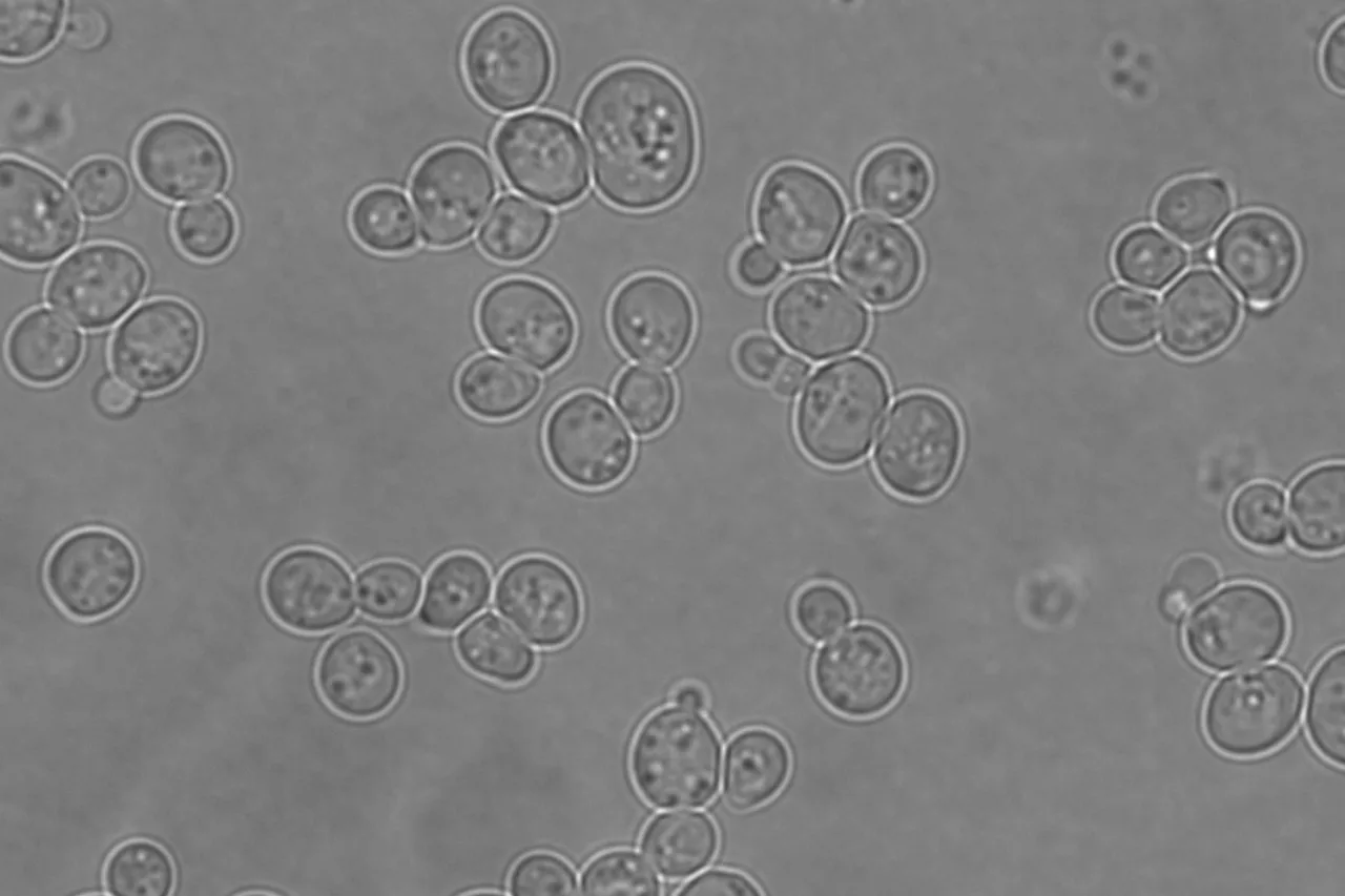 Cellule di lievito Saccharomyces cerevisiae al microscopio, alcune con la gemma di riproduzione